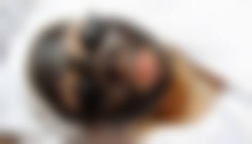 惠州市惠阳区人民医院求美者反馈