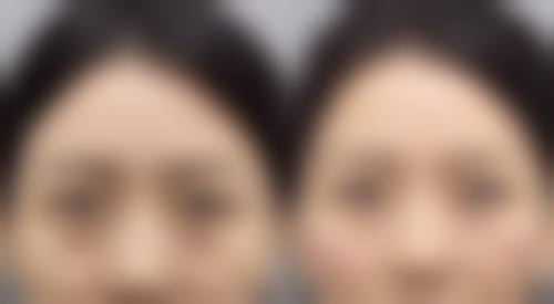 Regina皮肤医疗脱毛诊所价格收费