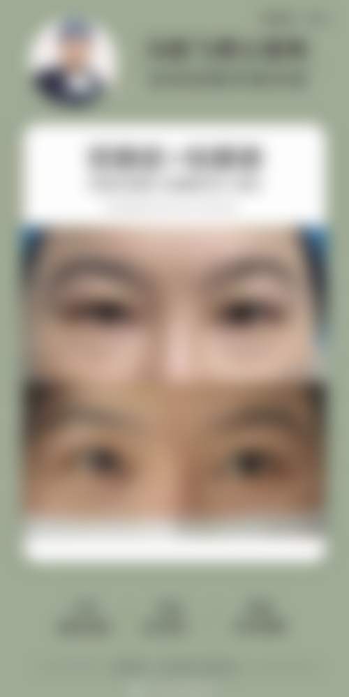 李想医生坚持的精细化医美服务理念