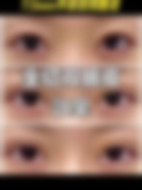 缇美思医美特色项目及技术优势