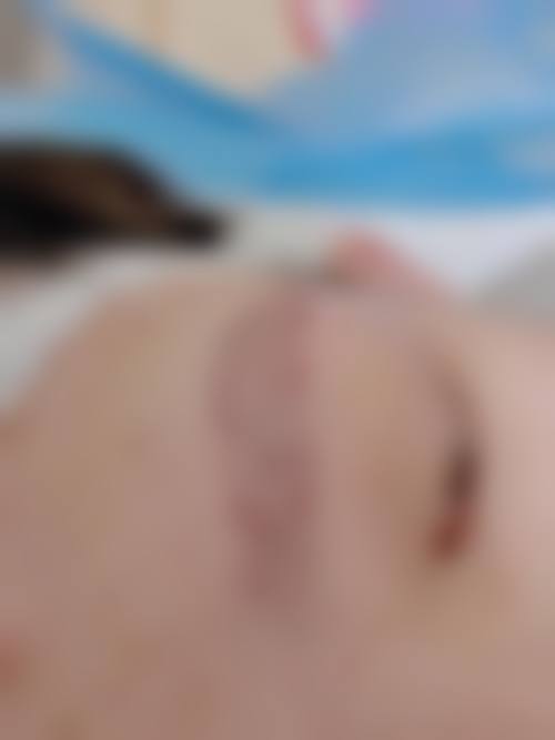 太原有为植发医院求美者反馈