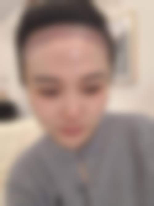 郑州华 山医疗美容医院求美者反馈