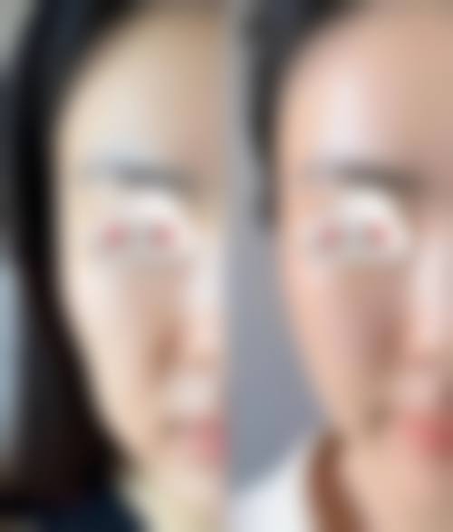 香港SKINBEAM整形医学美容中 心特色项目及技术优势