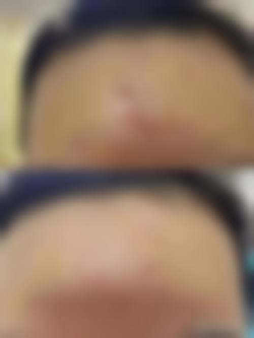 依托内蒙古伽蓝医疗美容的专精平台优势