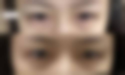 运城丽霞医疗美容诊所价格收费