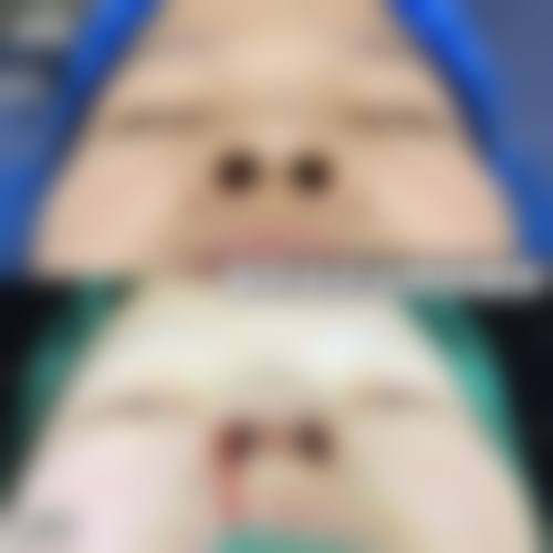 襄阳健桥整形医院求美者反馈