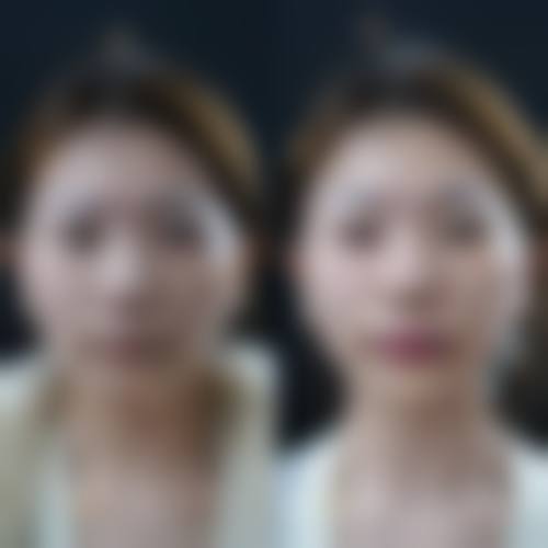 武汉美嘉整形医院特色项目及技术优势