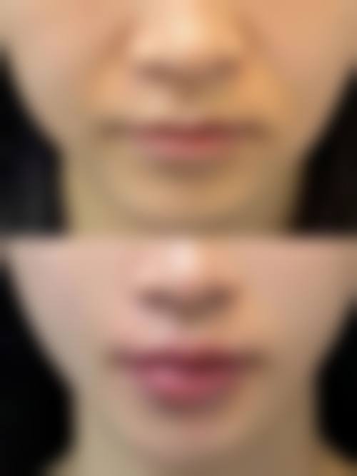 武汉美嘉整形医院求美者反馈