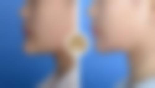 牛继峰医生的就诊预约与就医指南