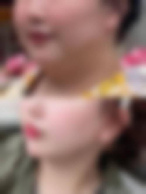 罗汇东医生覆盖全方面的核心擅长项目