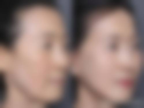 西安允美整形医疗美容门诊部求美者反馈