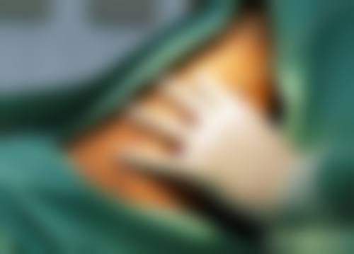 郑州中 心医院整形美容科的就诊保护与点位选择