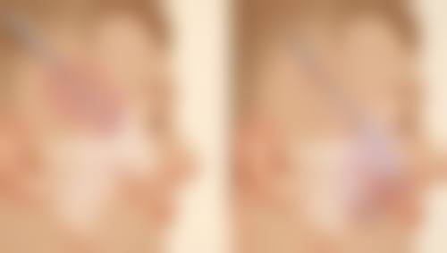 南京美范医疗美容诊所求美者反馈
