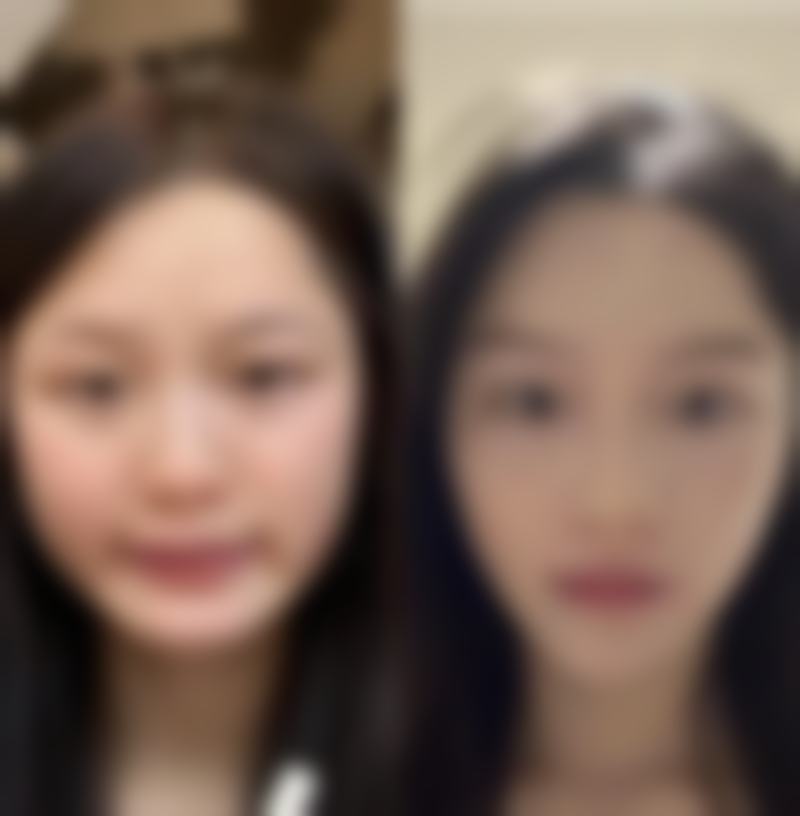 韩国微笑整形外科特色项目及技术优势