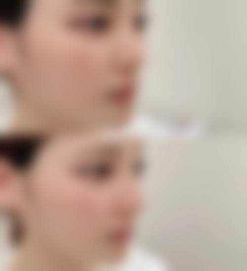重庆渝北珂琳雅医疗美容门诊部求美者反馈
