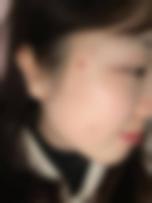 深圳甄颜医疗美容门诊部:为马红婕医师提供专精塑美平台
