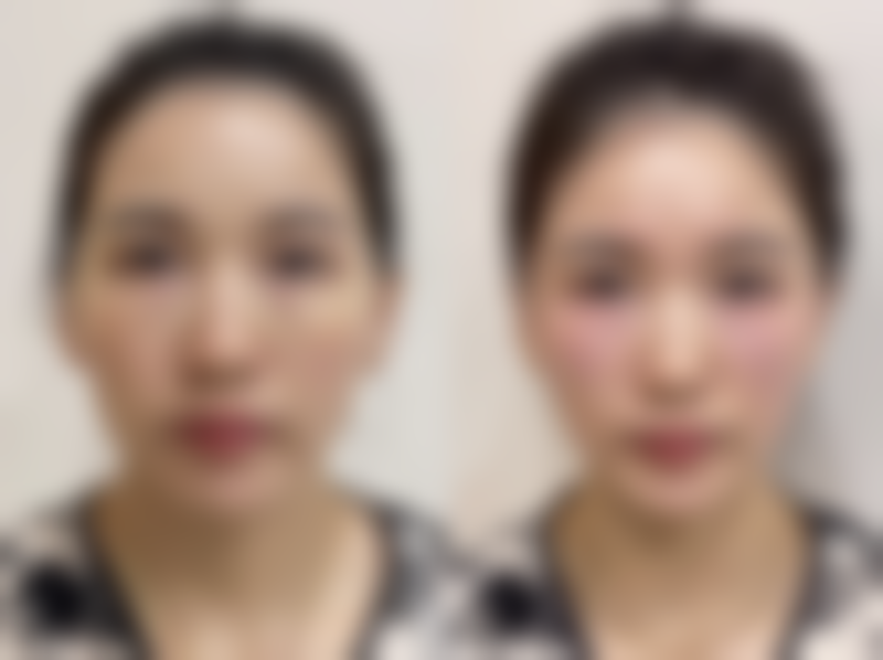 衢州市衢江芬华医疗美容诊所价格收费