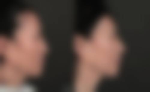 透明合理的医美收费体系