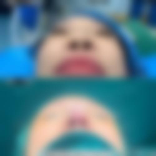 滁州坤知美医学美容诊所价格收费