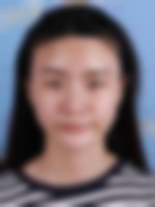 韩国灰姑娘整形医院价格收费