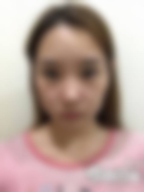 韩国灰姑娘整形医院求美者反馈