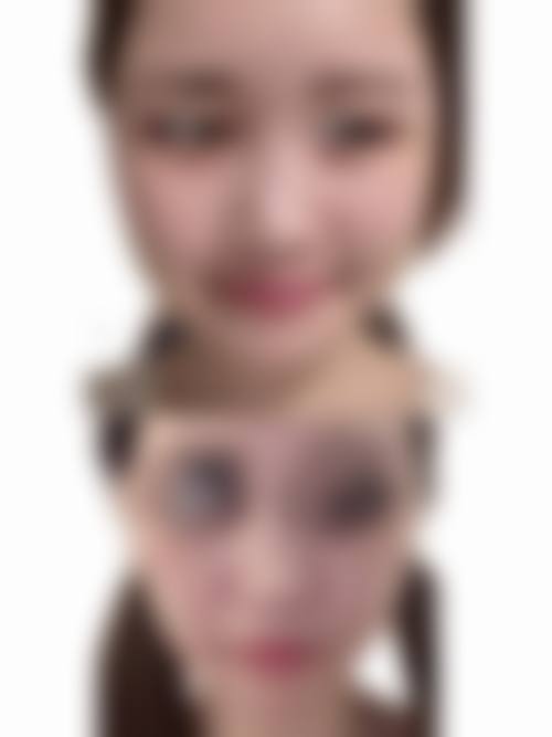 德阳一生美整形医疗美容诊所价格收费