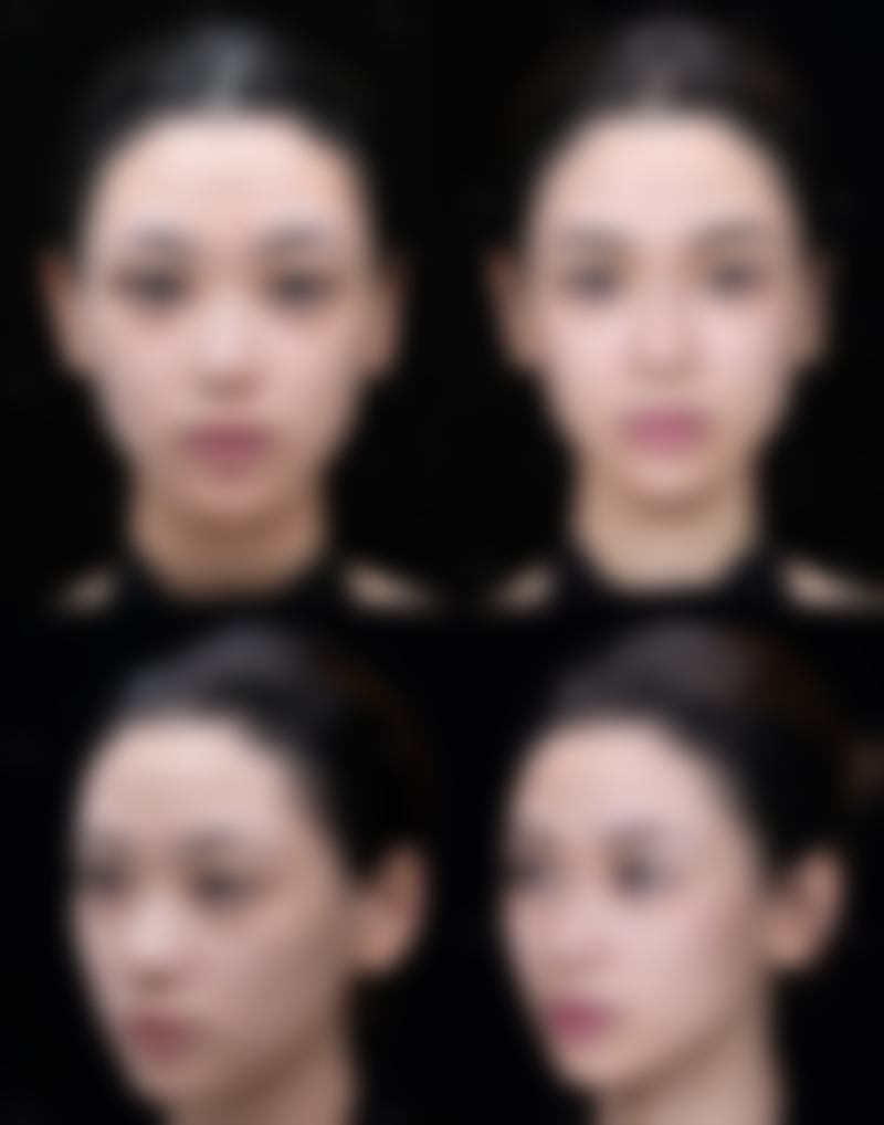 自由丘Precious美容诊所求美者反馈