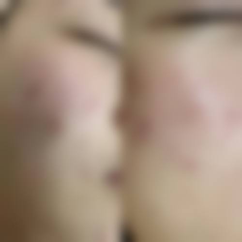 易阳亮医生依托正规医院的安心医美保护体系