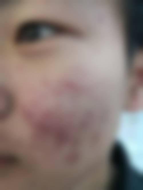 韩国newk皮肤科医院简介概述