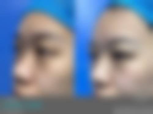 预约陈玉华面诊的便捷通道