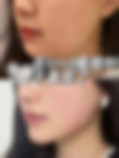 兰州美示整形美容诊所求美者反馈