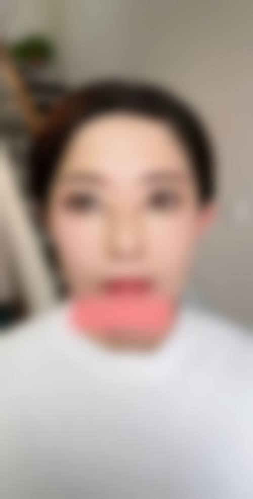 绵阳协和医院医学美容中 心求美者反馈