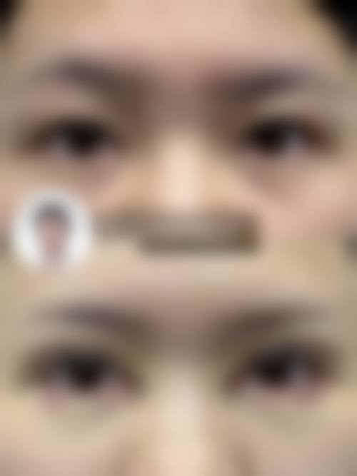 鄂州涞曼整形医院价格收费
