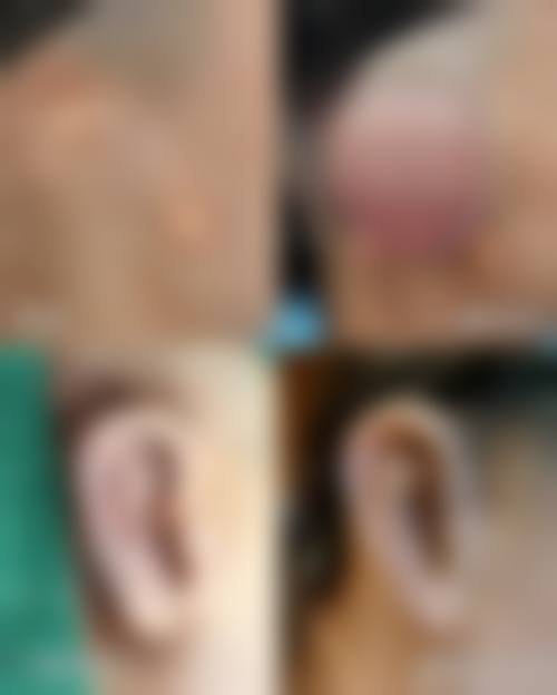 承德佳美医疗美容医院价格收费