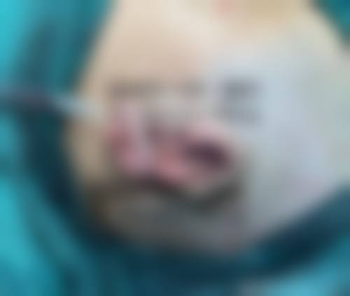 承德佳美医疗美容医院来院路线