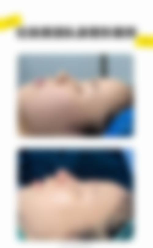 深圳福田华悦整形门诊部价格收费