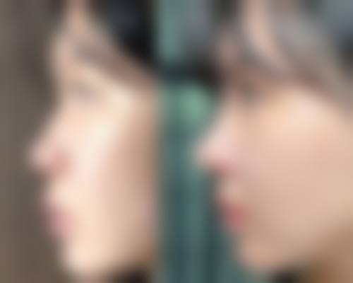 深圳广尔美丽医疗美容整形门诊部特色项目及技术优势