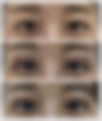 金华臻蓉颜医疗美容诊所特色项目及技术优势