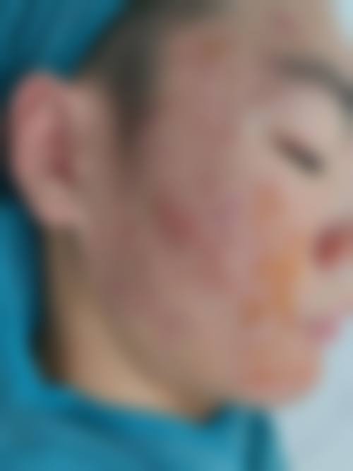 崔正军 医生的专精临床操作标准
