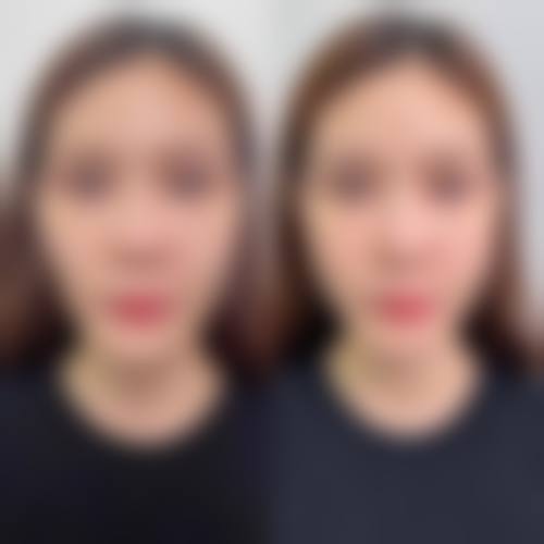 济南历下圣梦医疗美容诊所求美者反馈