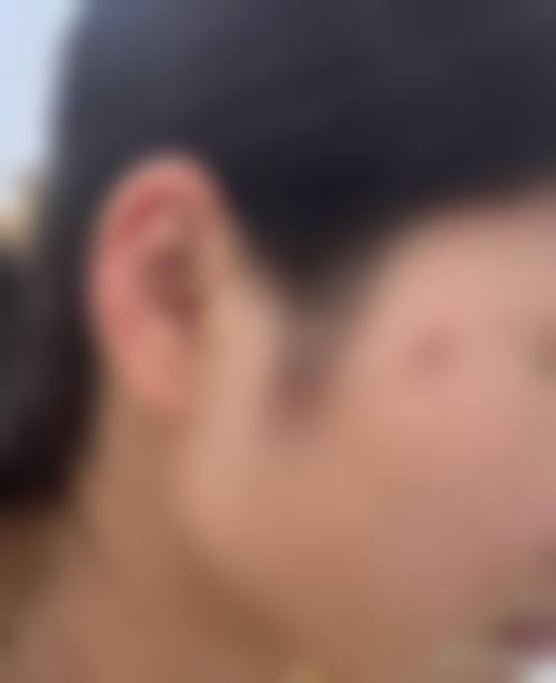东莞瑞芙臣整形美容门诊部特色项目及技术优势