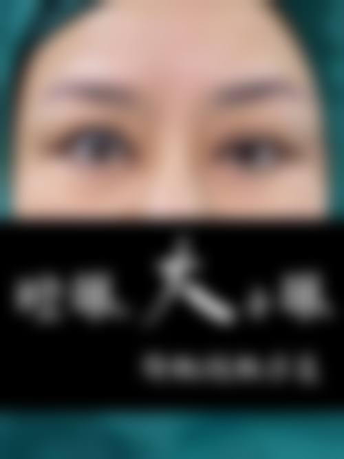 秦宏伟领衔团队的技术优势:安心与自然兼顾