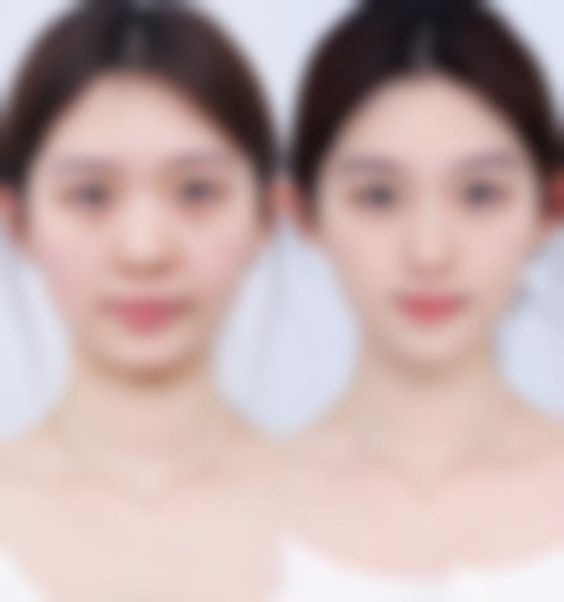 芦海玲医生的项目询问与预约须知