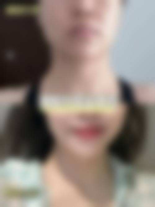 深圳芝华医疗美容门诊部求美者反馈