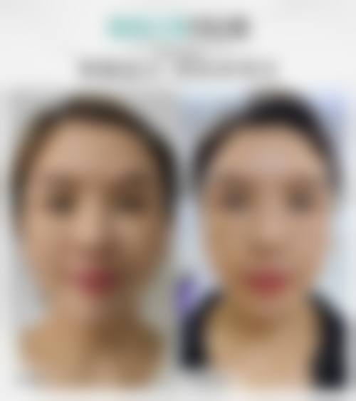 深圳美高医疗美容诊所价格收费