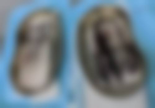 达州爱尔博视医院特色项目及技术优势