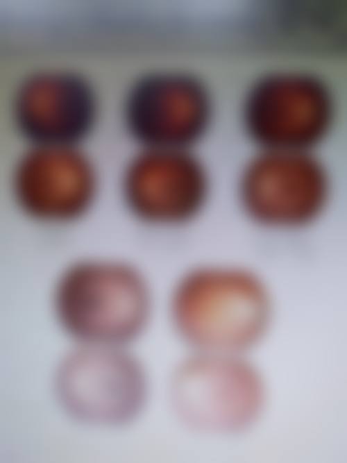 濉溪县医院眼科是正规的吗/怎么样/靠谱吗
