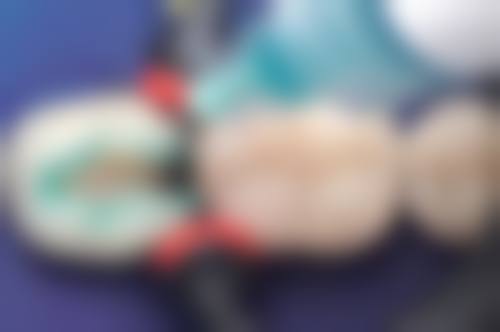南京维博口腔是正规的吗
