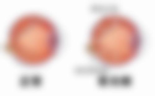 为什么要选择抚顺市中医院眼科?
