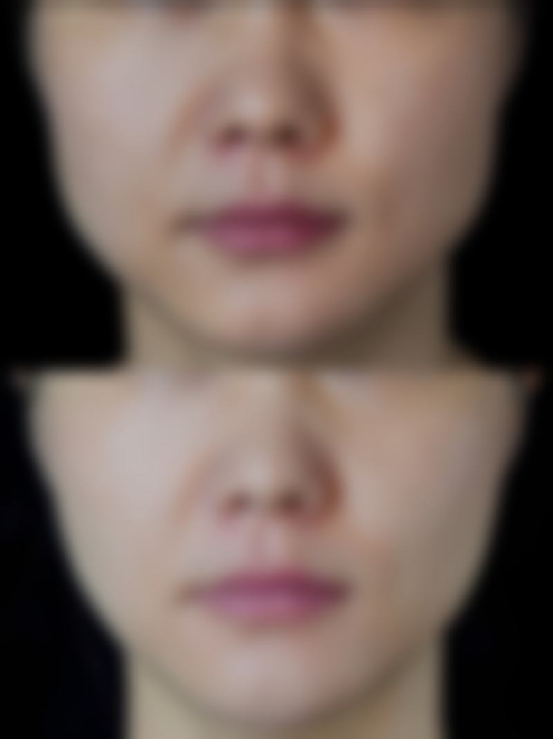 苏州美贝尔整形医院特色项目及技术优势